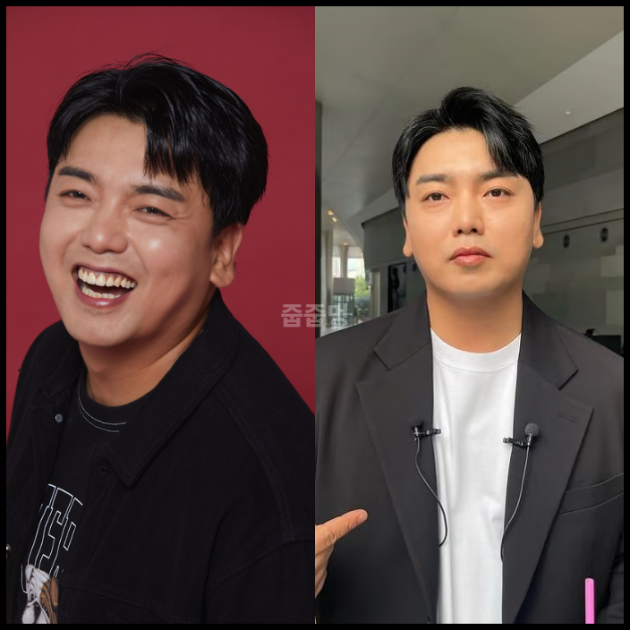 "곽범 얼굴에 수천만 원 쏟았다", 받은 시술 리스트 공개!