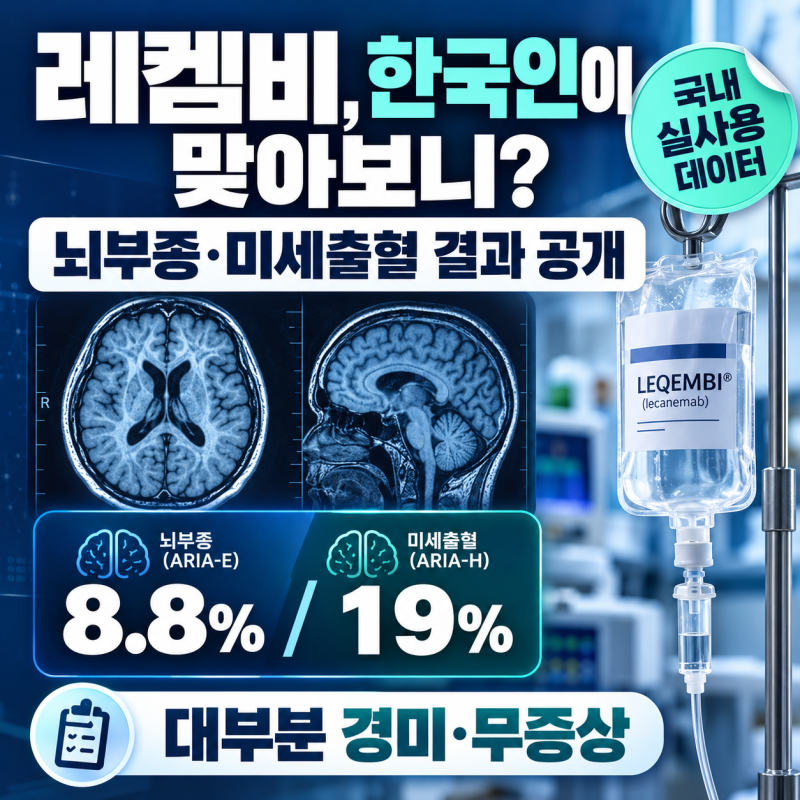 치매 신약 레켐비, 한국인에게 실제 써보니…‘뇌부종·미세출혈’ 얼마나 나왔나