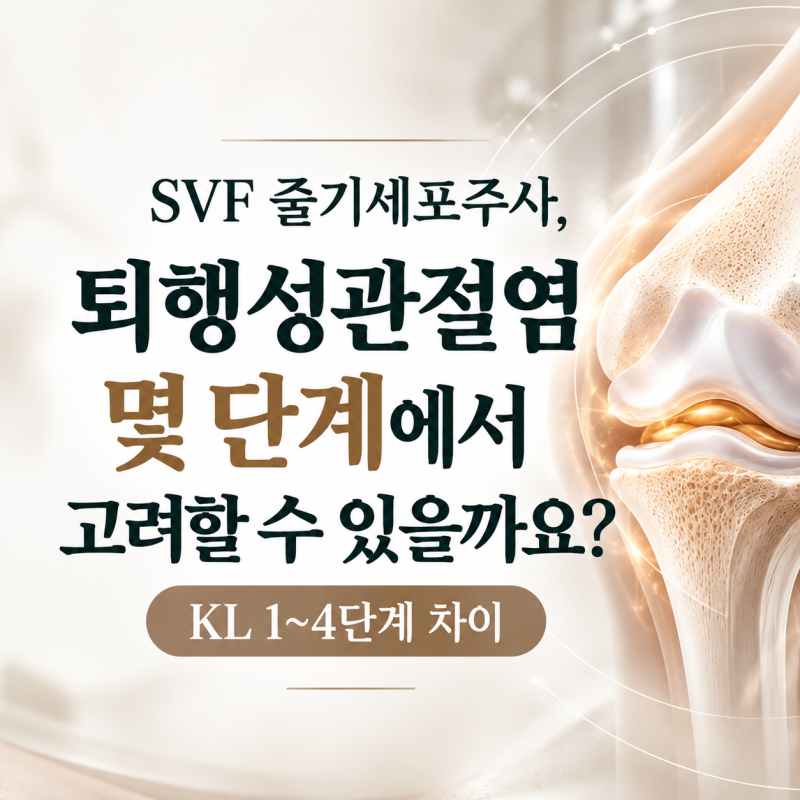 svf줄기세포주사, 퇴행성관절염 몇 단계에서 고려할 수 있을까요? KL 1~4단계 차이