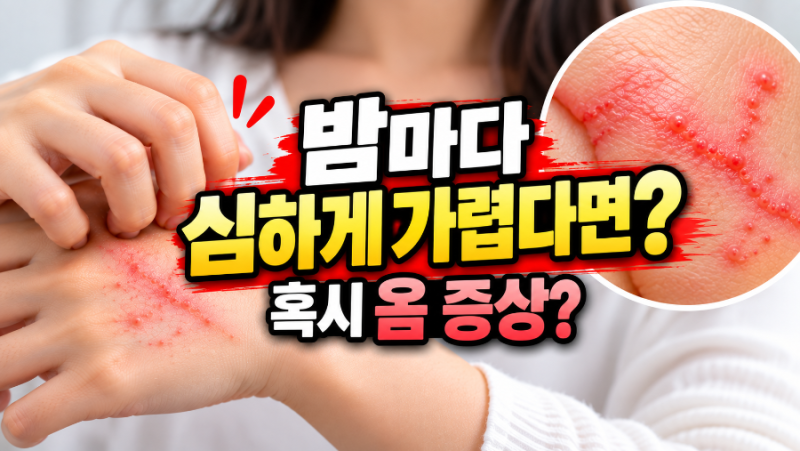 옴 증상 어떻게 나타날까? 초기증상·사진·잠복기·원인부터 옴 약까지