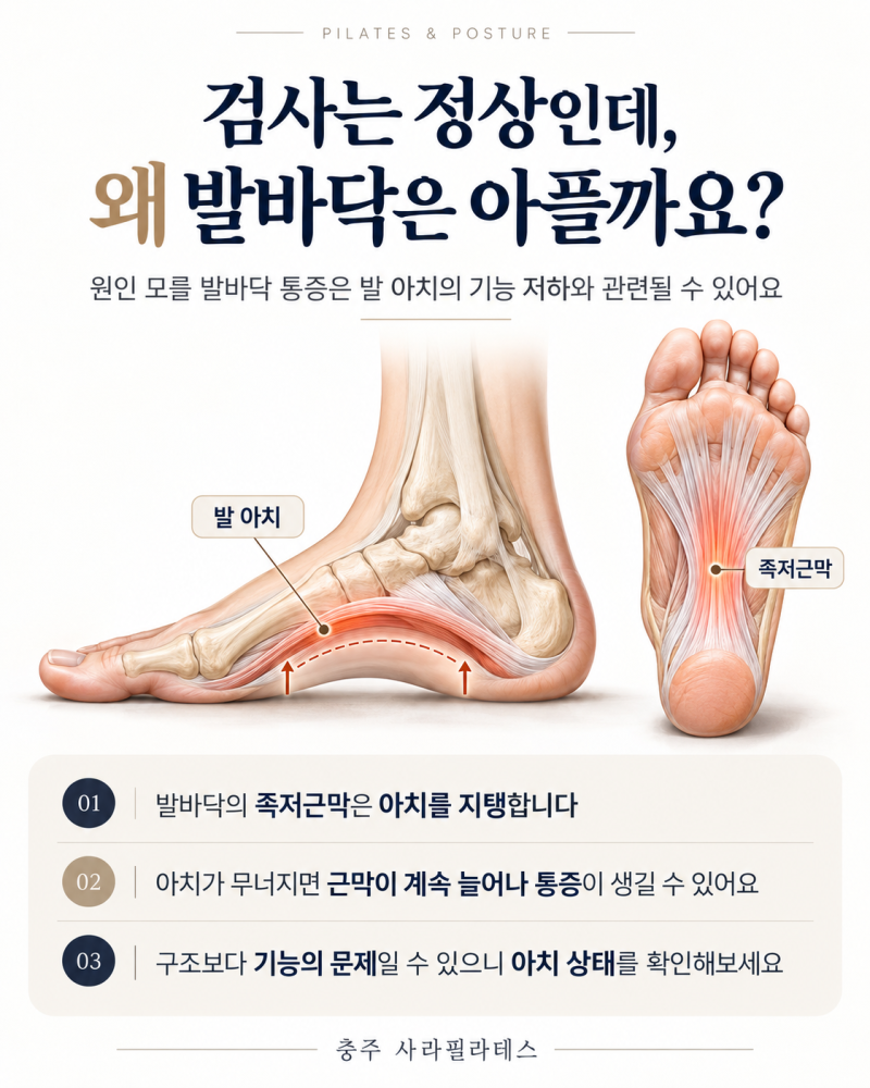충주발바닥통증/ 발바닥이 자주 아프다면 발 아치부터 확인해보세요 / 확인방법과 운동법까....