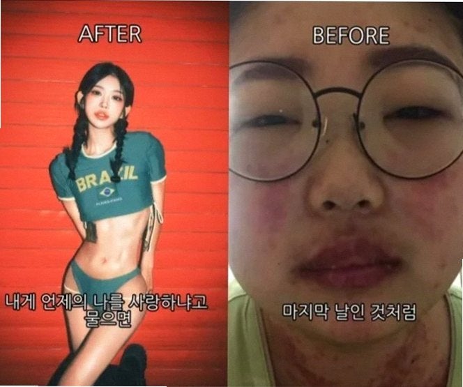 최준희 41kg 근황 96kg에서 55kg 뺀 비결과 흉곽 줄이기 시도한 이유 (연예뉴스)