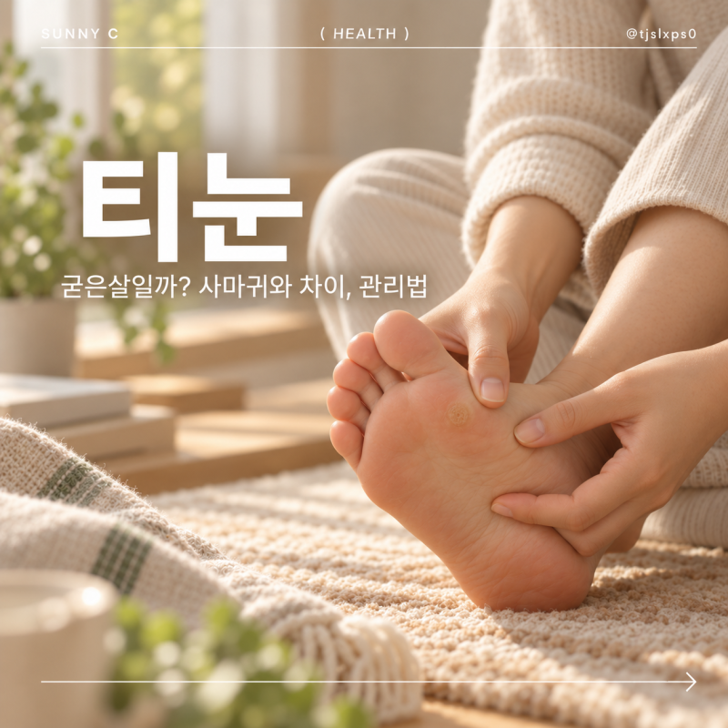 티눈 왜 생길까? 사마귀와 차이부터 제거 방법, 재발 예방법까지