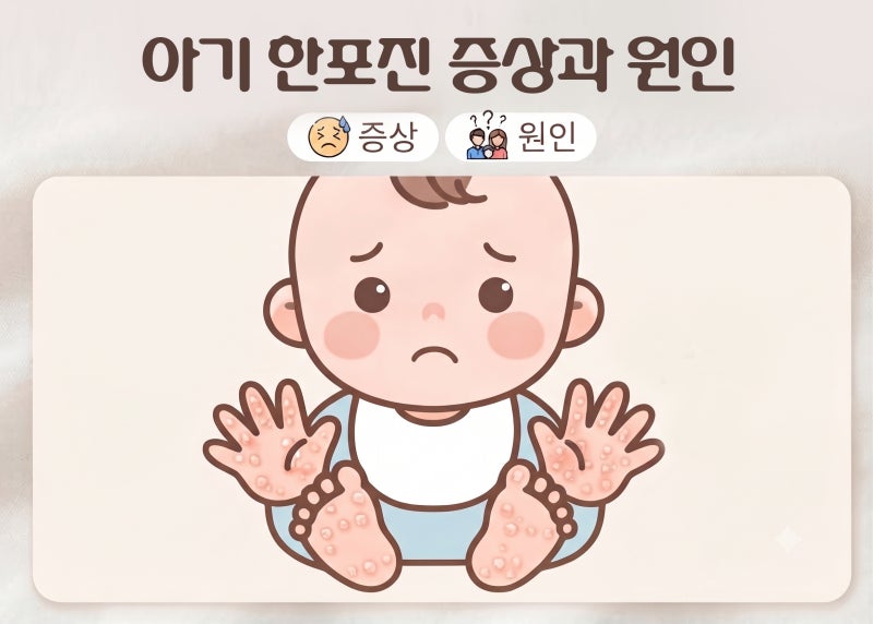 아기 한포진 증상과 원인 손바닥 발바닥 손가락 부위별 특징까지!
