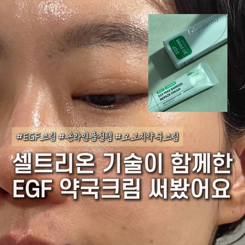 EGF 피부장벽크림 추천 전문관리 후 사용하기 괜찮은 약국크림 지피덤
