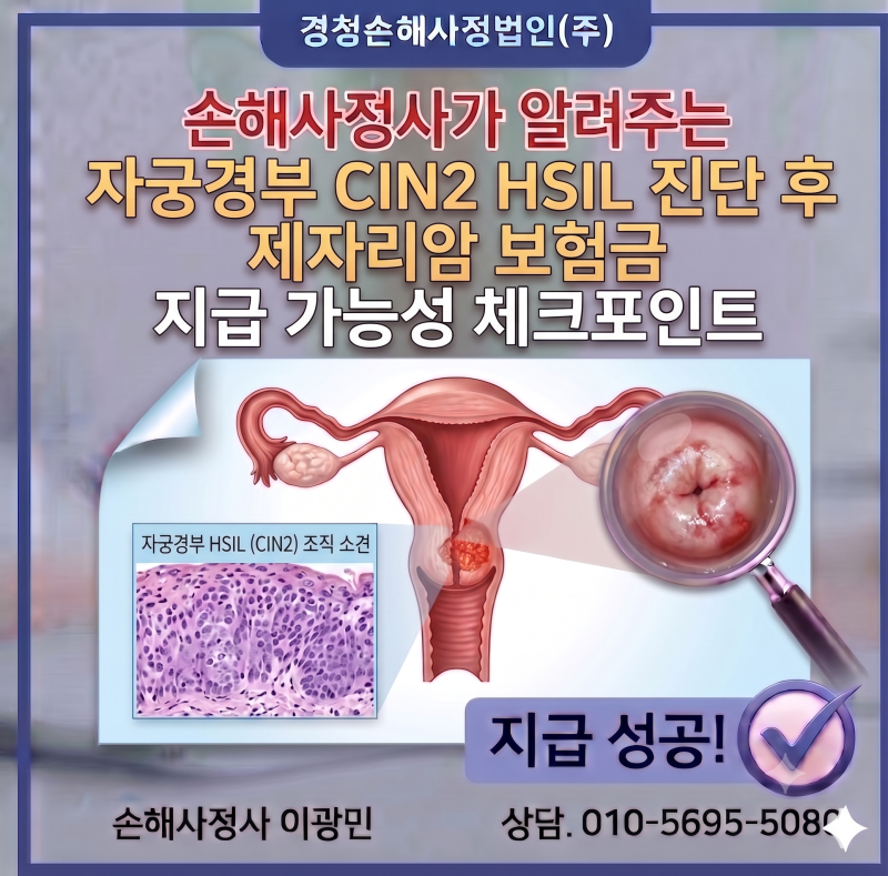 자궁경부 CIN2 HSIL 진단 후 제자리암 보험금 지급 가능성 체크포인트