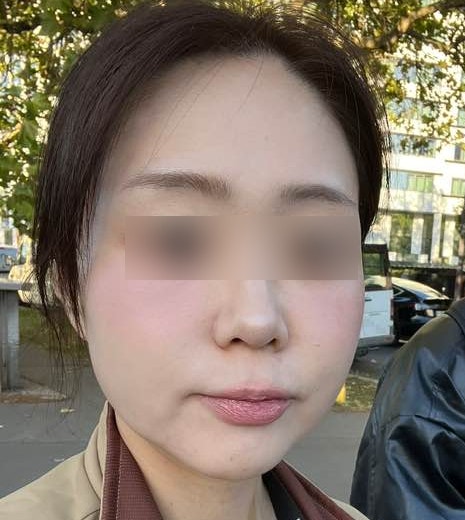서울대입구역피부과 레티젠 콜라겐스킨부스터 효과 추천 후기