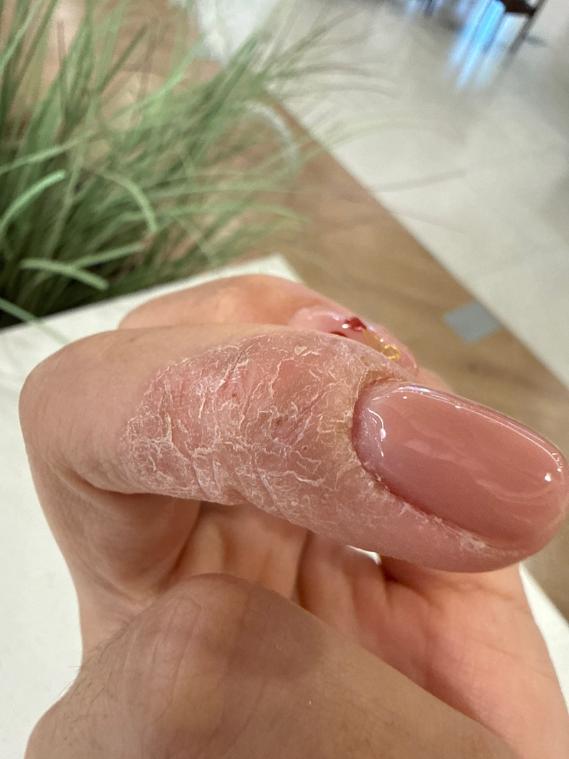 일주일에 5kg빼기 시너지 7일 원팩 다이어트 디톡스 후기