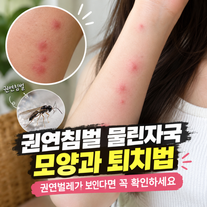 권연침벌 물린자국 모양과 퇴치법, 권연벌레가 보인다면 꼭 확인하세요