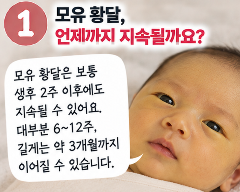 모유 황달 언제까지.? 아기 신생아 황달 확인방법, 분유 시기