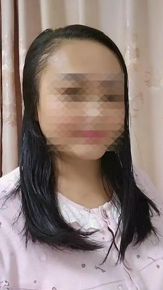 헬리코박터균전염확률 검사 후 생활이 이렇게 달라졌어요