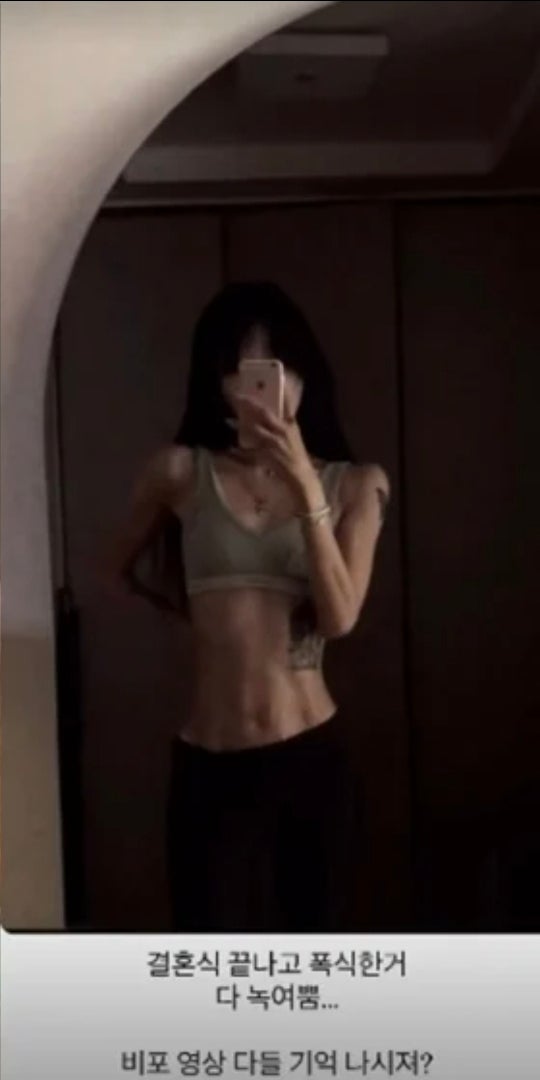 성형 중독…'41kg 뼈말라' 최준희 "흉곽 줄이려다 포기"