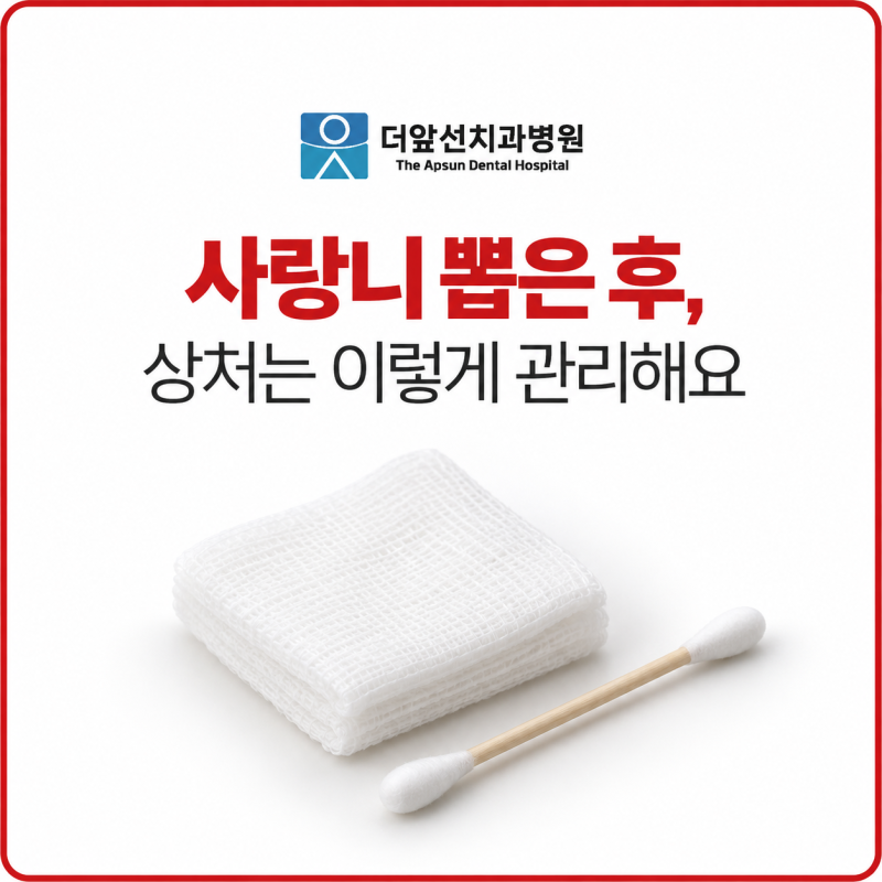 창원사랑니치과ㅣ사랑니 뽑은 후, 실밥과 상처는 어떻게 관리하나요?