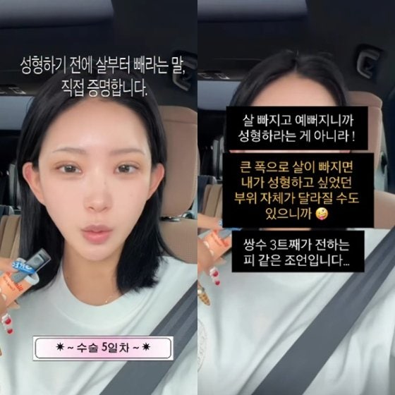 96kg→41kg 최준희, 이번엔 ‘흉곽 줄이기’까지? 직접 밝힌 충격적인 다이어트 과정