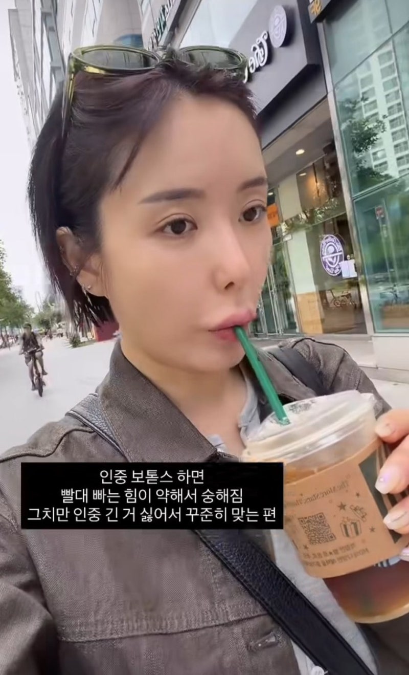 이소라가 또 털어놓은 시술, 2022년 이후 순서대로 보니 결국 이런 패턴이었다