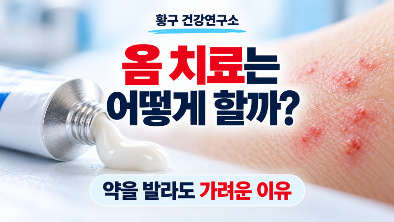 옴 치료는 어떻게 할까? 약을 발라도 가려운 이유