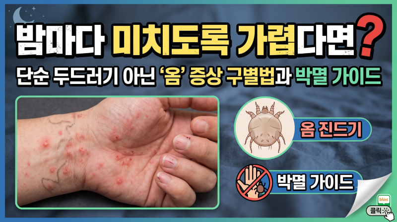 밤마다 미치도록 가렵다면? 단순 두드러기 아닌 '옴' 증상 구별법과 박멸 가이드