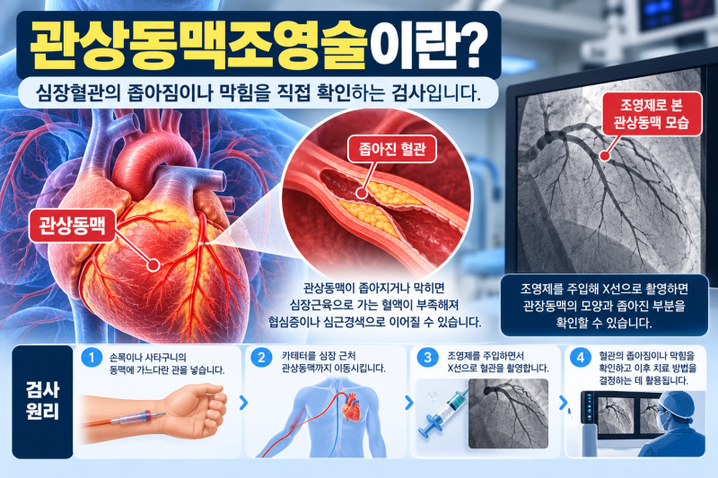 관상동맥조영술 검사 전 알아둘 것, 조영제·금식·검사시간 정리