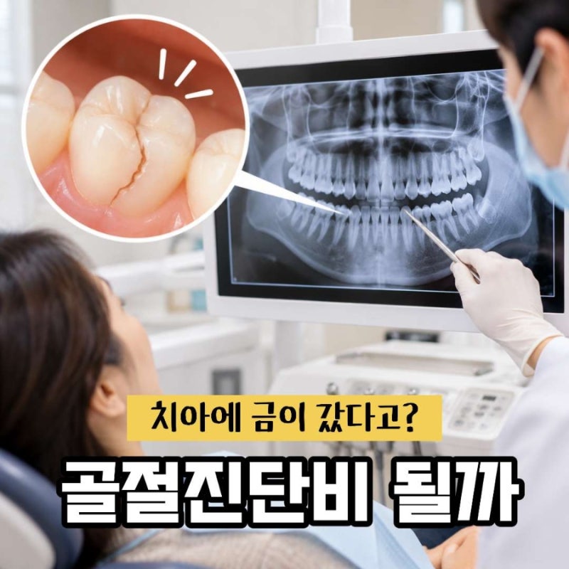 치아에 금이 갔는데 보험금 받을 수 있을까? 골절진단비와 치아균열·파절 확인