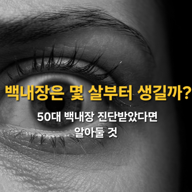 50대 백내장 진단, 너무 이른 걸까? 백내장 원인과 수술 시기