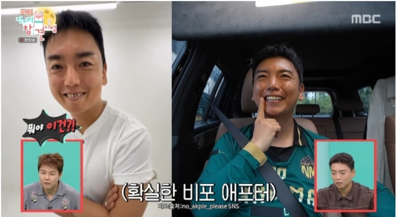 2천만원 들인 16개 치아가 이렇게 달랐나, 곽범, 치아 시술 전 사진 공개 후 다시 보인 변화