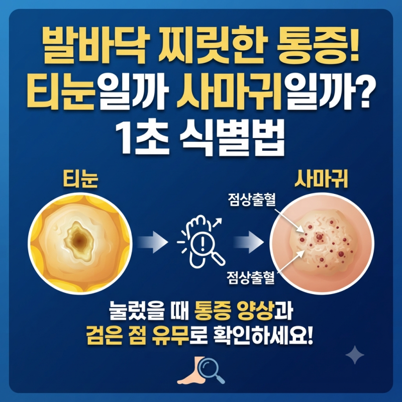 발바닥 사마귀 티눈 구분 방법? 통증 위치와 점으로 1초 만에 확인하기