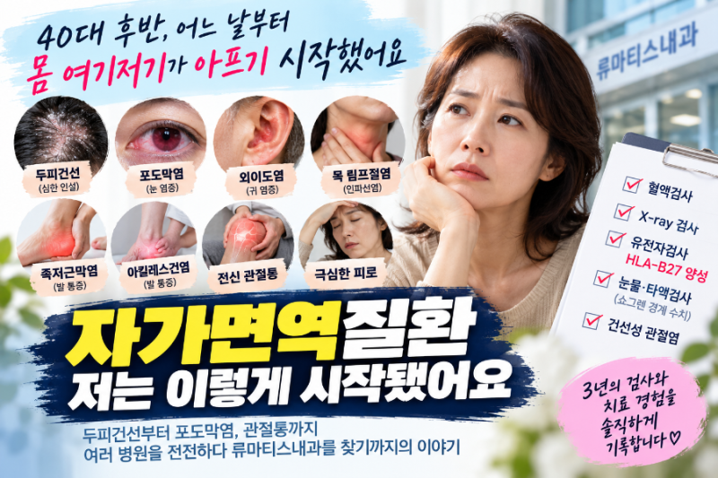 자가면역질환 증상, 저는 이렇게 시작됐어요｜두피건선·포도막염·관절통 끝에 류마티스내....