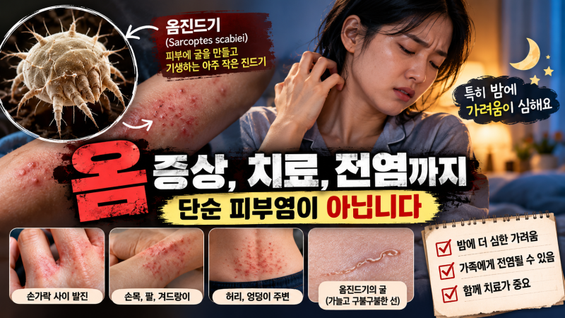 “밤만 되면 미친 듯이 가렵다면?” 옴 증상 - 단순 피부염인 줄 알았는데 가족까지 함께 치....