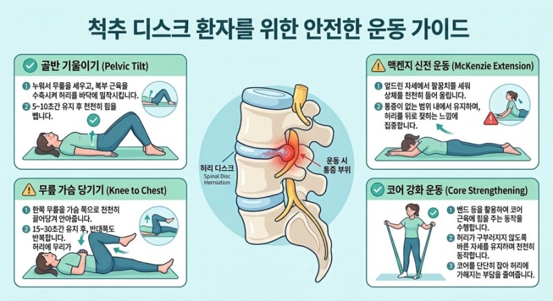 “ 허리디스크에는 어떤 운동을 해야 할까? "골반 기울기부터 맥켄지 신전·무릎 가슴 대기·....