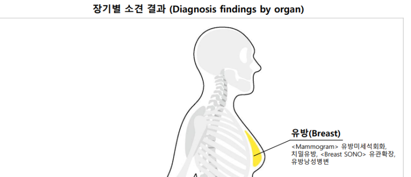 유방 미세석회화 진단받고 놀란 사람에게｜유방외과 찾기부터 조직검사까지