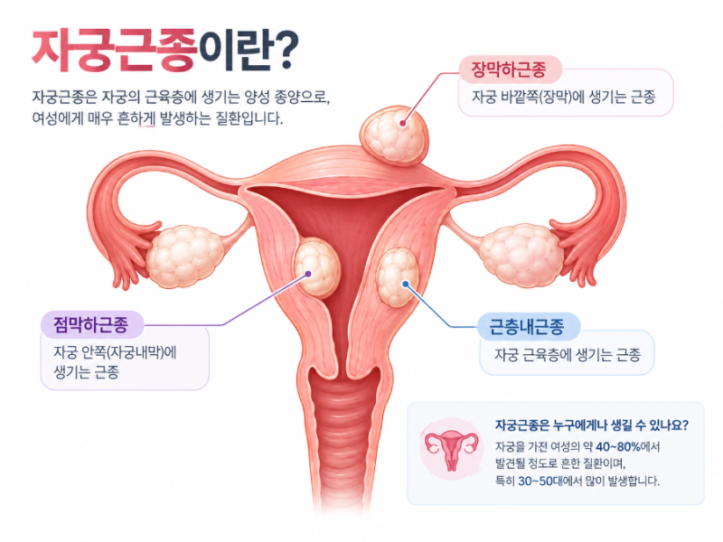 자궁근종 증상부터 수술까지｜자궁경·복강경·개복수술 차이 정리