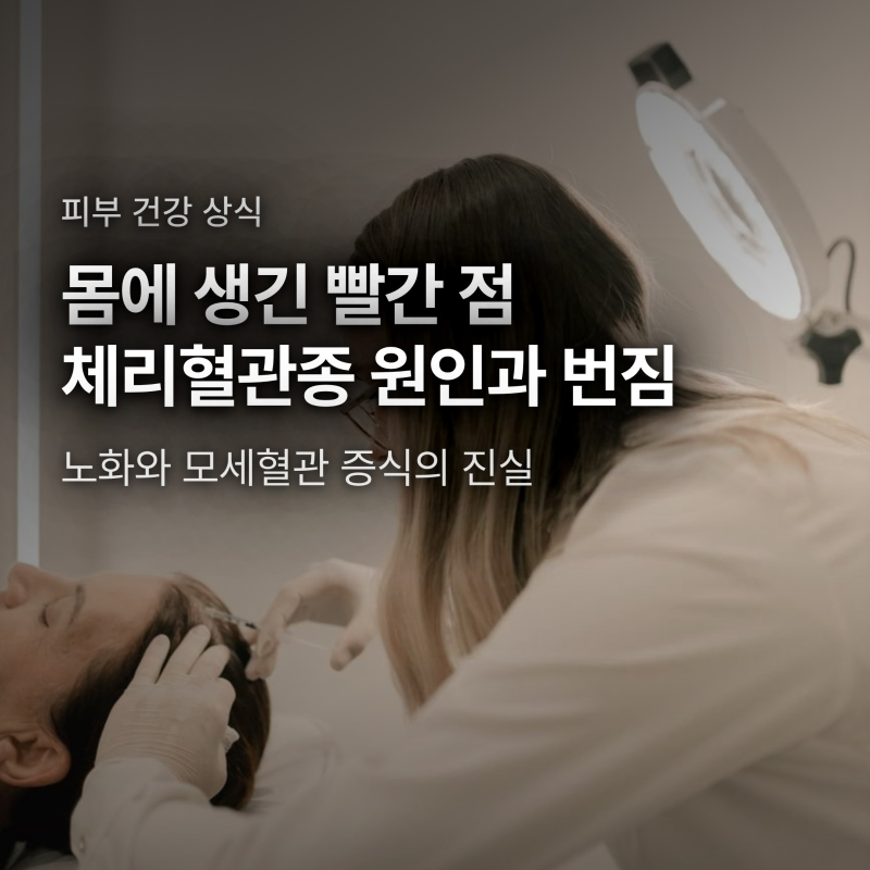 빨간 점 체리혈관종 생기는 원인과 번짐 여부, 자반증·피부암 구분법