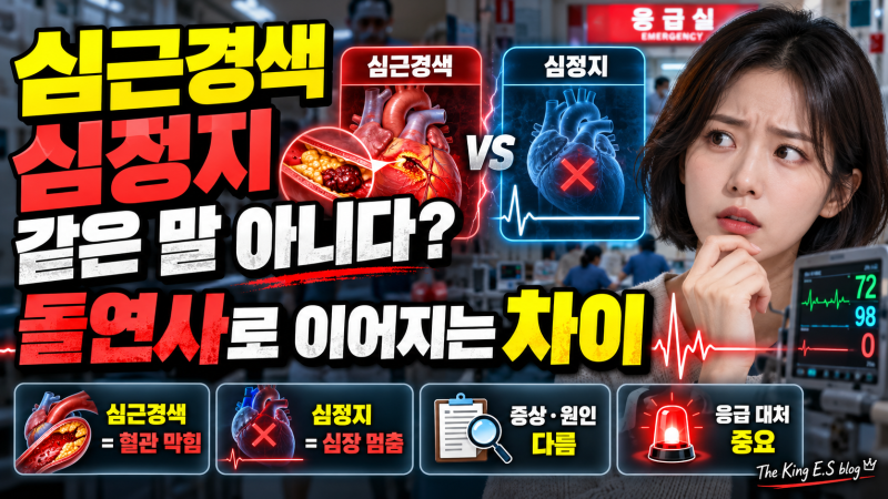 심근경색과 심정지, 같은 말 아니다? 돌연사로 이어지는 차이 [The King E.S blog]