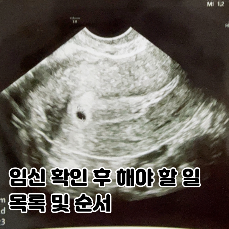 임신 확인 후 바로 해야 할 일 목록 순서 임신확인서 발급 임산부 등록