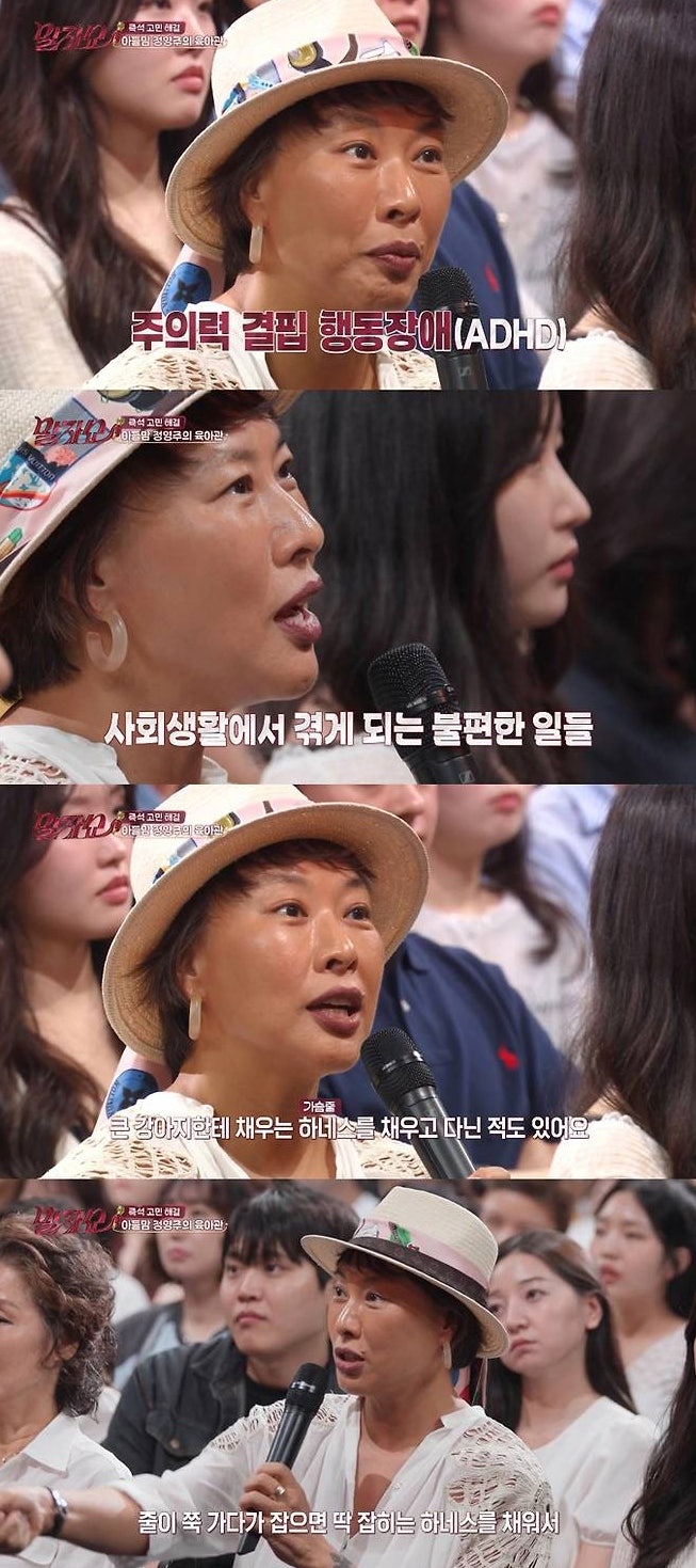 뮤지컬 배우 정영주 아들 얼굴에 1400바늘 꿰맨 안타까운 사고와 극복기