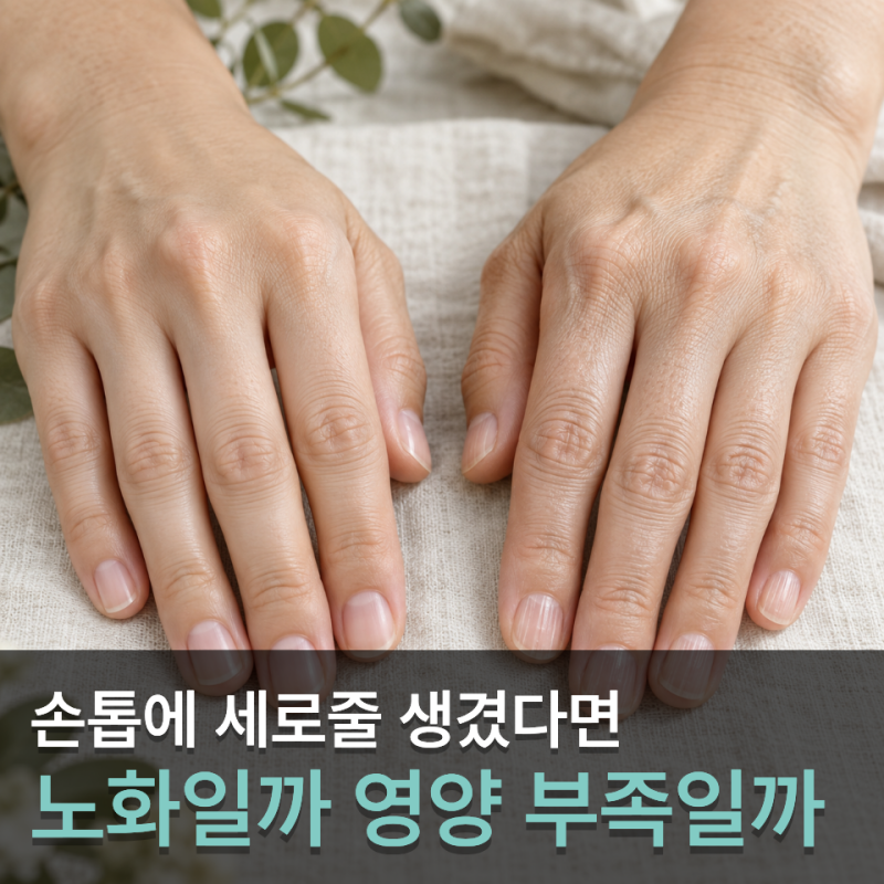 노화일까 영양 부족일까 손톱 세로줄 생기는 이유 비교해보니