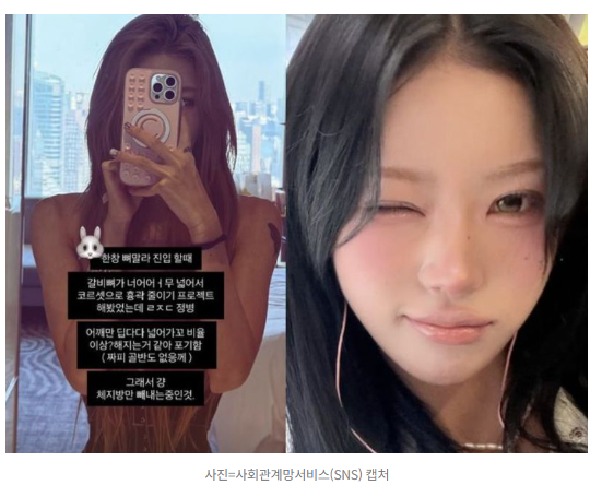 최준희 ‘갈비뼈가 넓다’? 공개된 건 교정 수술보다 금 간 갈비와 코르셋흉곽 교정은 한 가....
