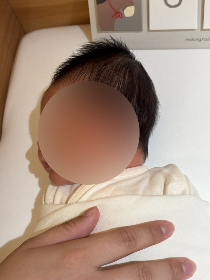 신생아 황달 수치 원인 증상, 생후 3일 광선치료 후기