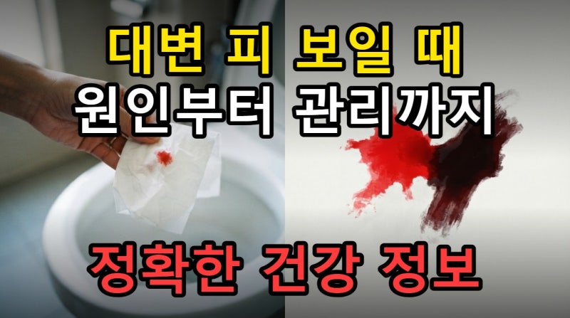 대변 선홍색 혈변 원인 구분부터 물티슈 비데 사용법까지 총정리