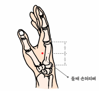 속 쓰림·위산 역류 싹 가라앉히는 손지압 건강법