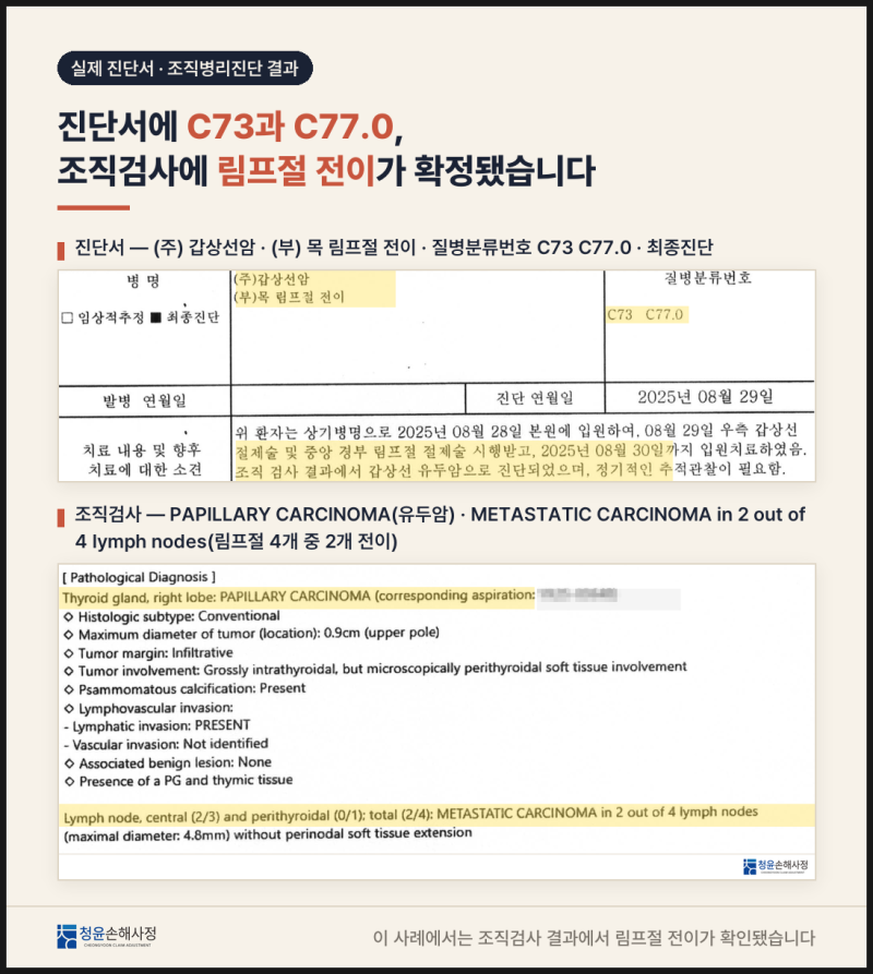 갑상선암 림프절 전이 C77, 일반암 진단비 지급 사례와 대법원 판결