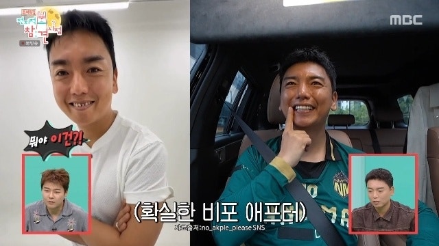 곽범, 치아 시술 전 사진 공개, "이건 방송 불가"… 수천만 원 쓴 얼굴 전후 변화