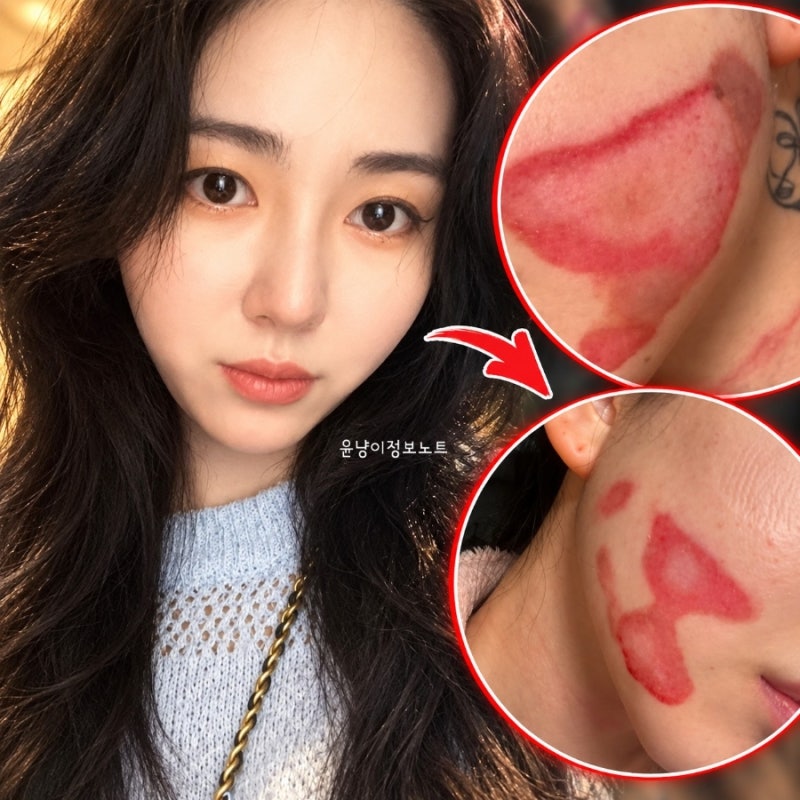 'AOA 탈퇴' 권민아, 피부과 환불 갈등에 녹취록 공개…"내가 나쁜짓거리 참 많이 했나봅니다"