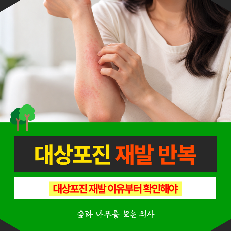 대상포진 재발 반복된다면? 대상포진 재발 이유부터 확인해야