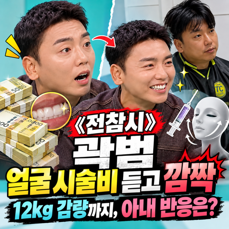 《전참시》 곽범 얼굴 시술비 듣고 깜짝｜12kg 감량까지, 아내 반응은?