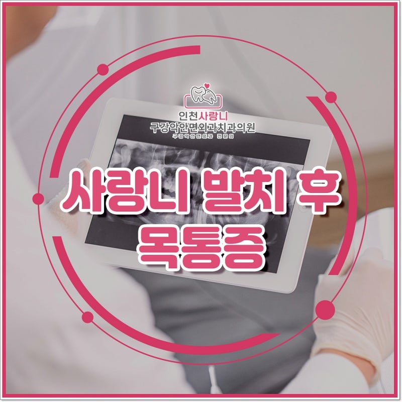 사랑니 발치 후 목통증, 입 벌리기도 어렵다면 어떻게 대처할까요?