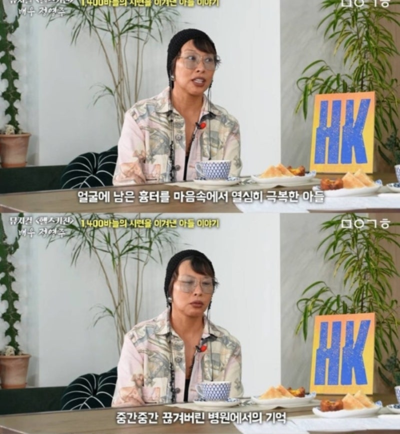 정영주 아들 얼굴 1,400바늘…살아준 것만으로 감사했던 엄마, 상처는 아물어도 부모의 마음....