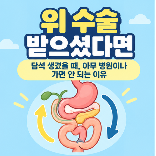 예전에 위 수술 받으셨다면, 담석 생겼을 때 아무 병원이나 가면 안 되는 이유