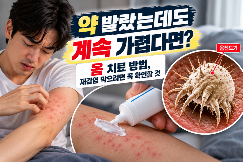 약 발랐는데도 계속 가렵다면?” 옴 치료 방법, 재감염 막으려면 꼭 확인할 것