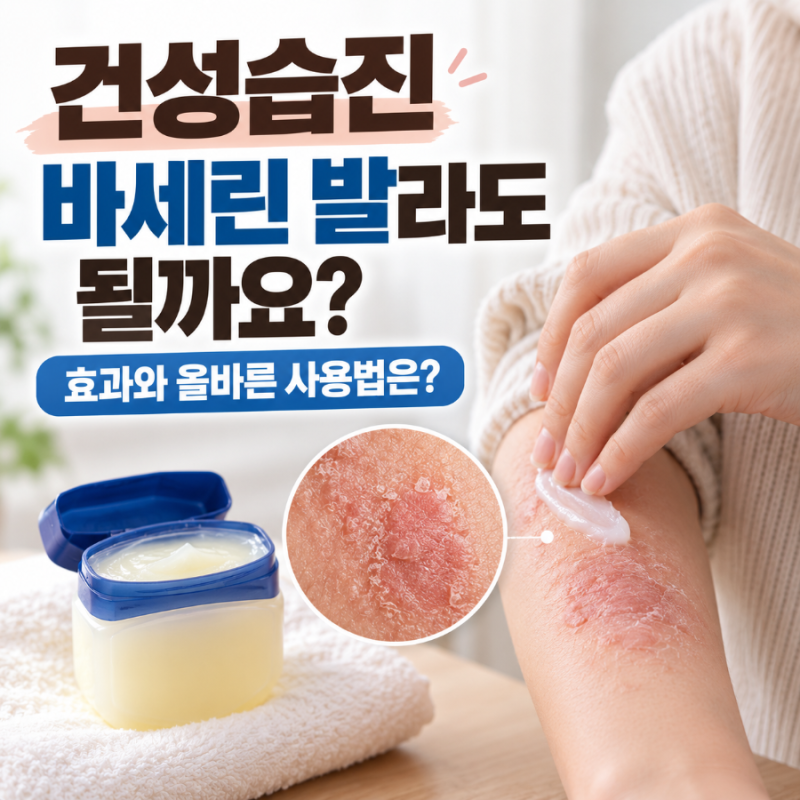 건성습진 바세린 발라도 될까요? 효과와 올바른 사용법은?